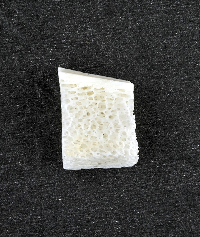 Bone-gaining techniques